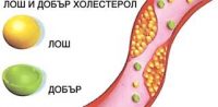 Висок холестерол и кръвно
